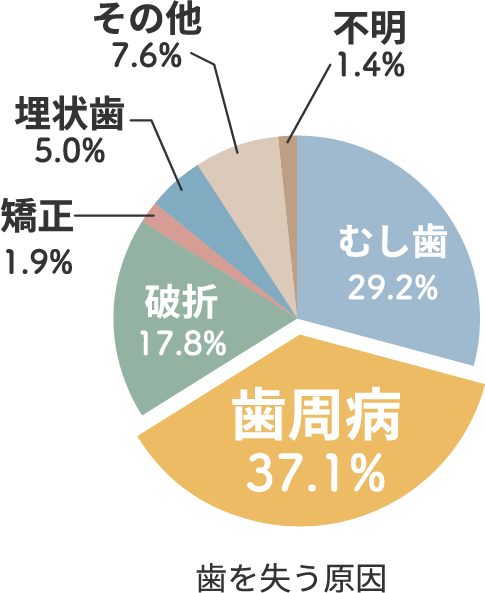 歯を失う原因　歯周病37.1%、むし歯29.2%、破折17.8%、埋伏歯5%、矯正1.9%、その他7.6%、不明1.4%