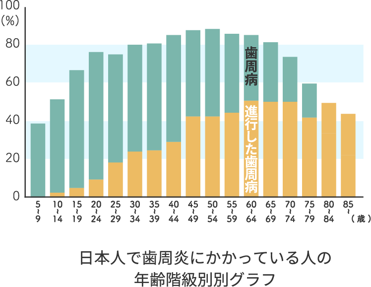 日本人で歯周炎にかかっている人の年齢階級別グラフ