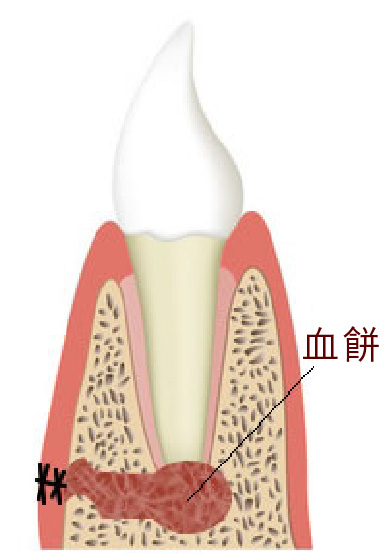 患部を縫合